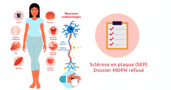 Quel taux invalidite pour sclérose en plaques ?